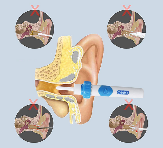 C-EARS appareil électrique de nettoyage des oreilles + étui et brosse