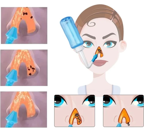 HOUDIAN Neti Pot irigator nazal pentru copii și adulți, 2 capete, 300 ml